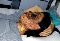 Gao Rongrong, setelah rusak oleh penyiksaan sengatan listrik (foto diambil 10 hari setelah terluka)