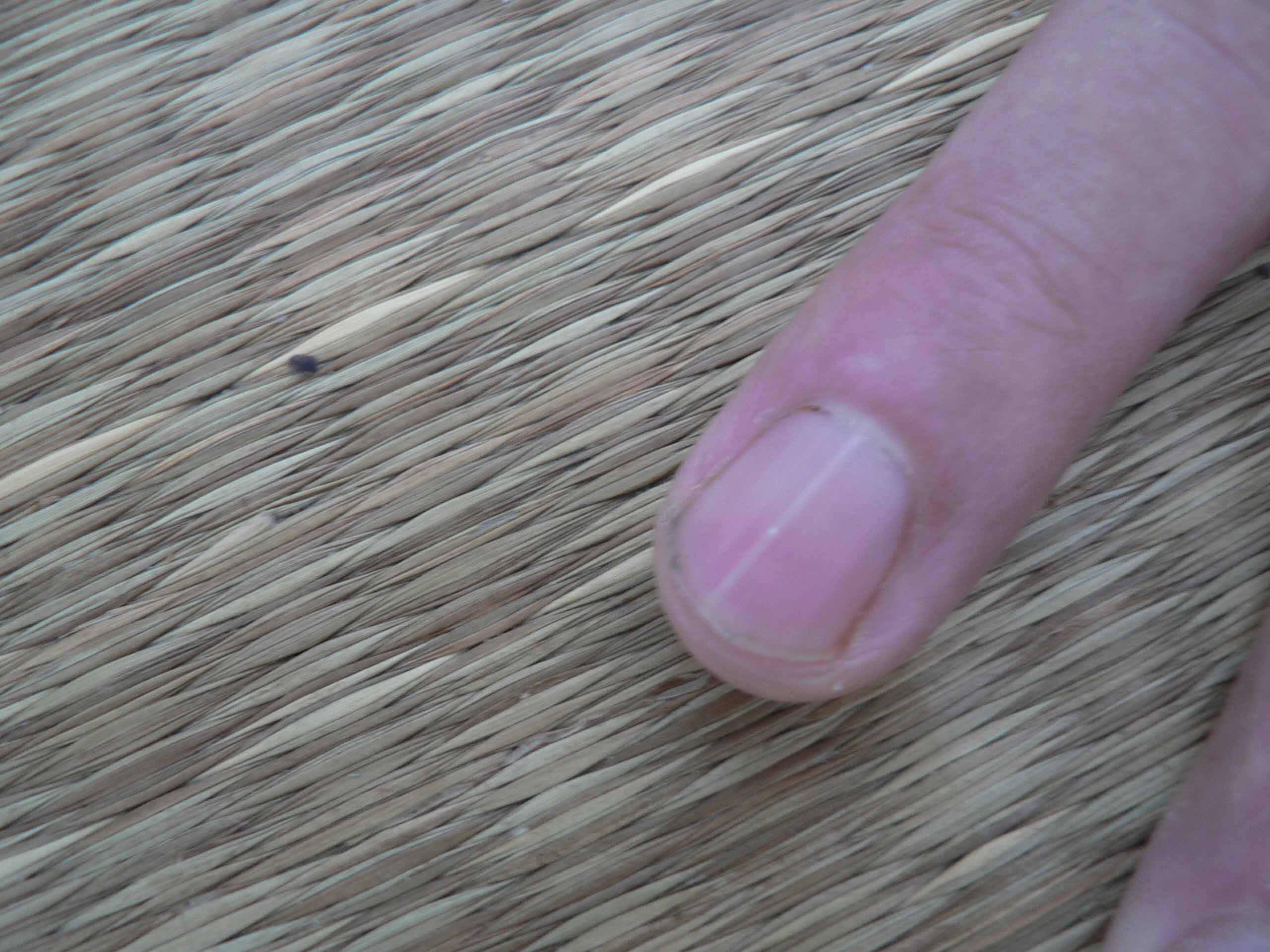 Brutal Torture Methods Inserting Needles Into Fingertips Burning Fingernails And Pulling Off Fingernails With Pliers Photos Falun Dafa Minghui Org